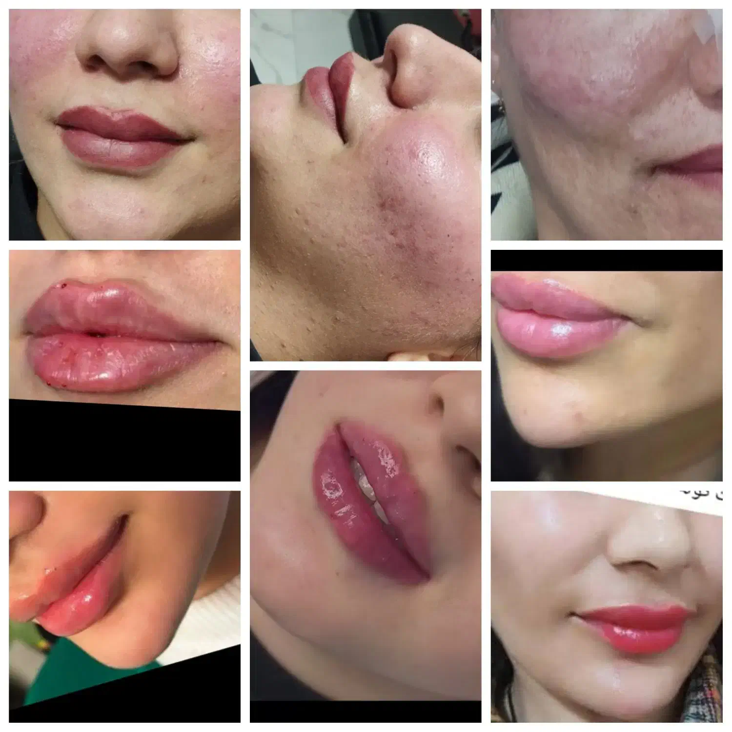 زیبایی پوست ومو|خدمات آرایشگری و زیبایی|ایذه, |دیوار