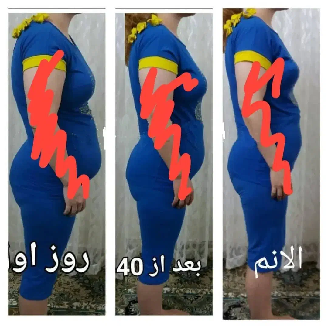 مینی پک لاغری تخفیف ویژه شب یلدا|فعالیت داوطلبانه|بندرعباس, |دیوار