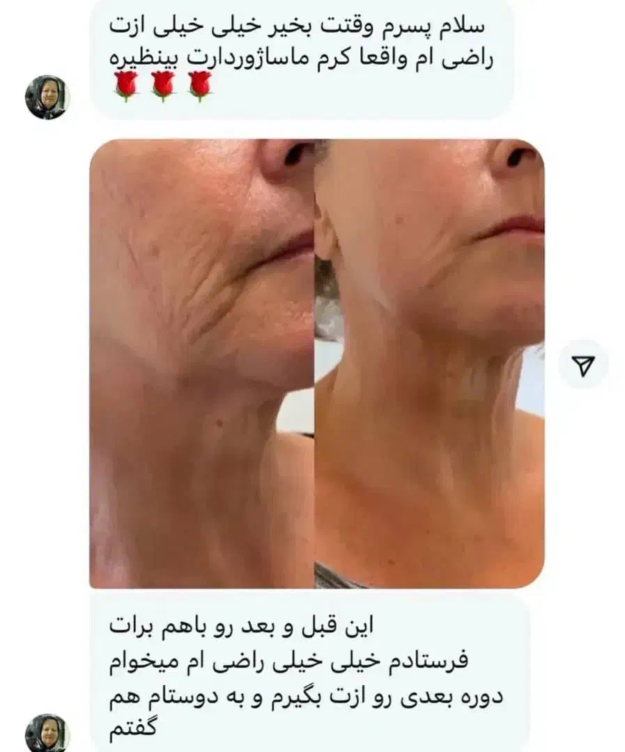 کرم بیوممتیک لاکچری کویین|آرایشی، بهداشتی، درمانی|اهواز, شهرک نفت|دیوار