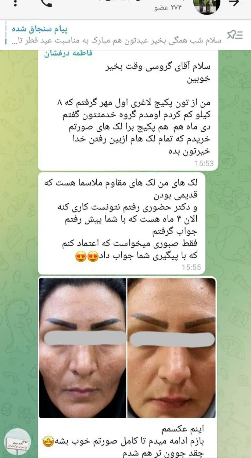 پوست زیبا و بدون آرایش|آرایشی، بهداشتی، درمانی|اهواز, منازل کارون|دیوار