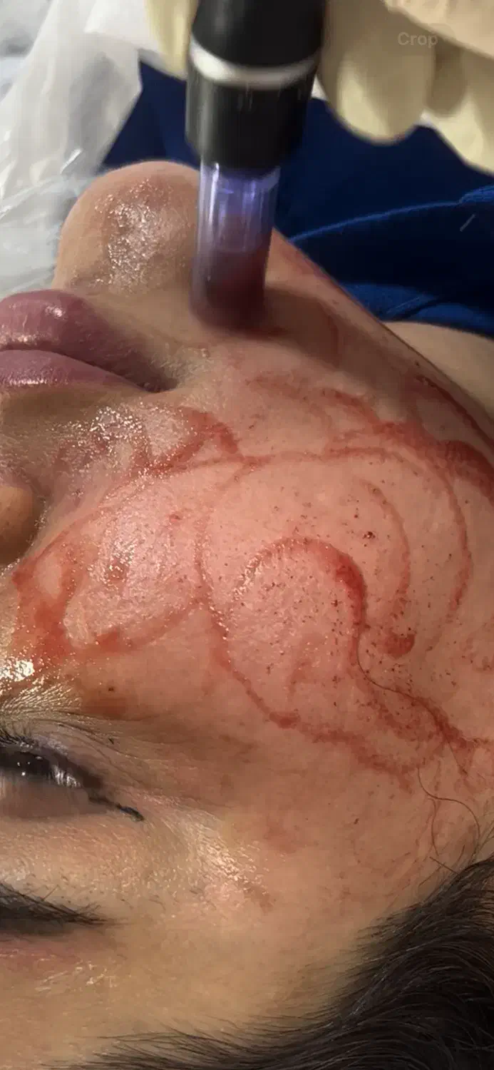 پاکسازی و فیشال تخصصی(بانوان)|خدمات آرایشگری و زیبایی|شاهین‌شهر, حافظ شمالی|دیوار