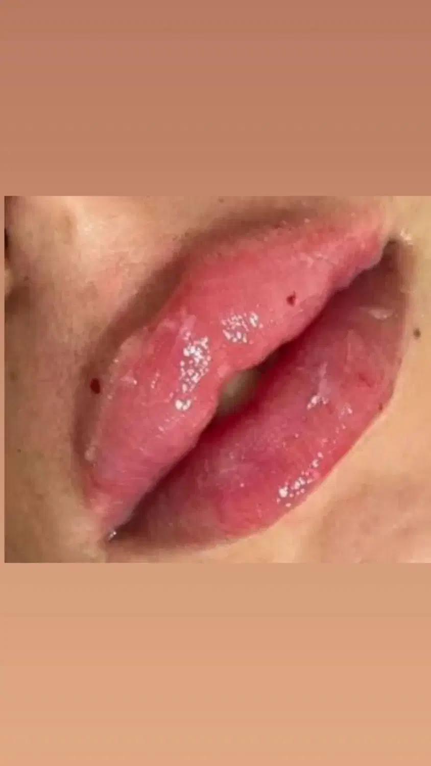 آموزش و انجام تمام خدمات ژل و بوتاکس|خدمات آرایشگری و زیبایی|هشتگرد, شهرک ولیعصر (مصلی)|دیوار