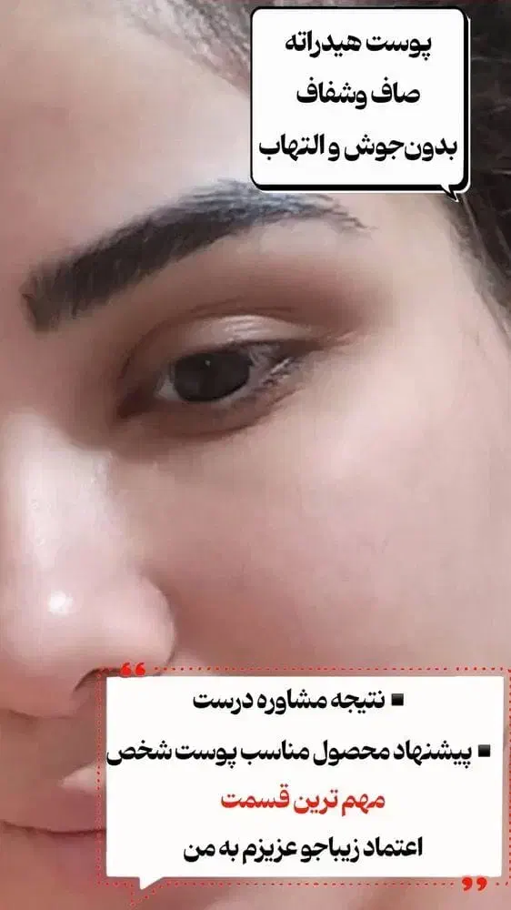 پووست موو|آرایشی، بهداشتی، درمانی|چیتاب, |دیوار