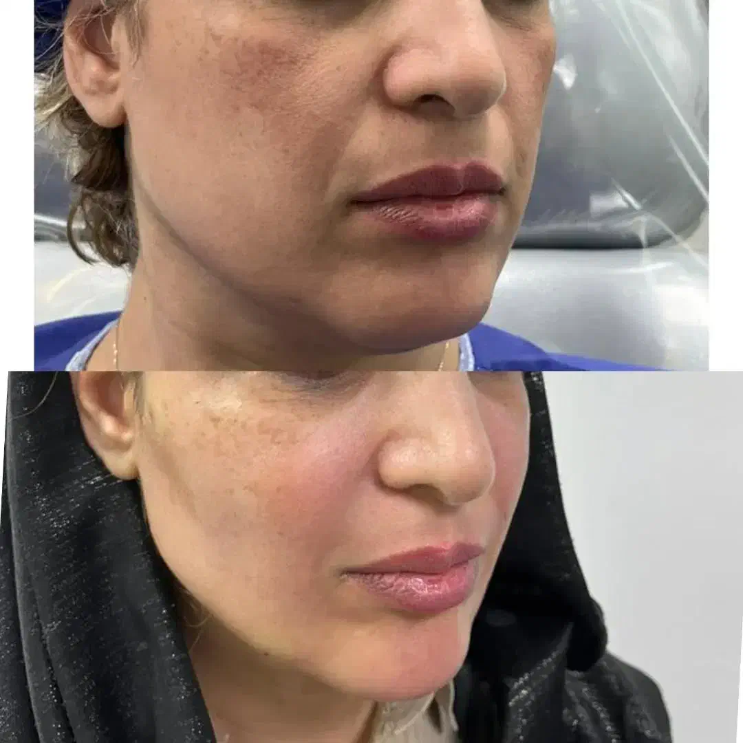 کلینیک تخصصی پوست و مو|خدمات آرایشگری و زیبایی|اهواز, پردیس|دیوار