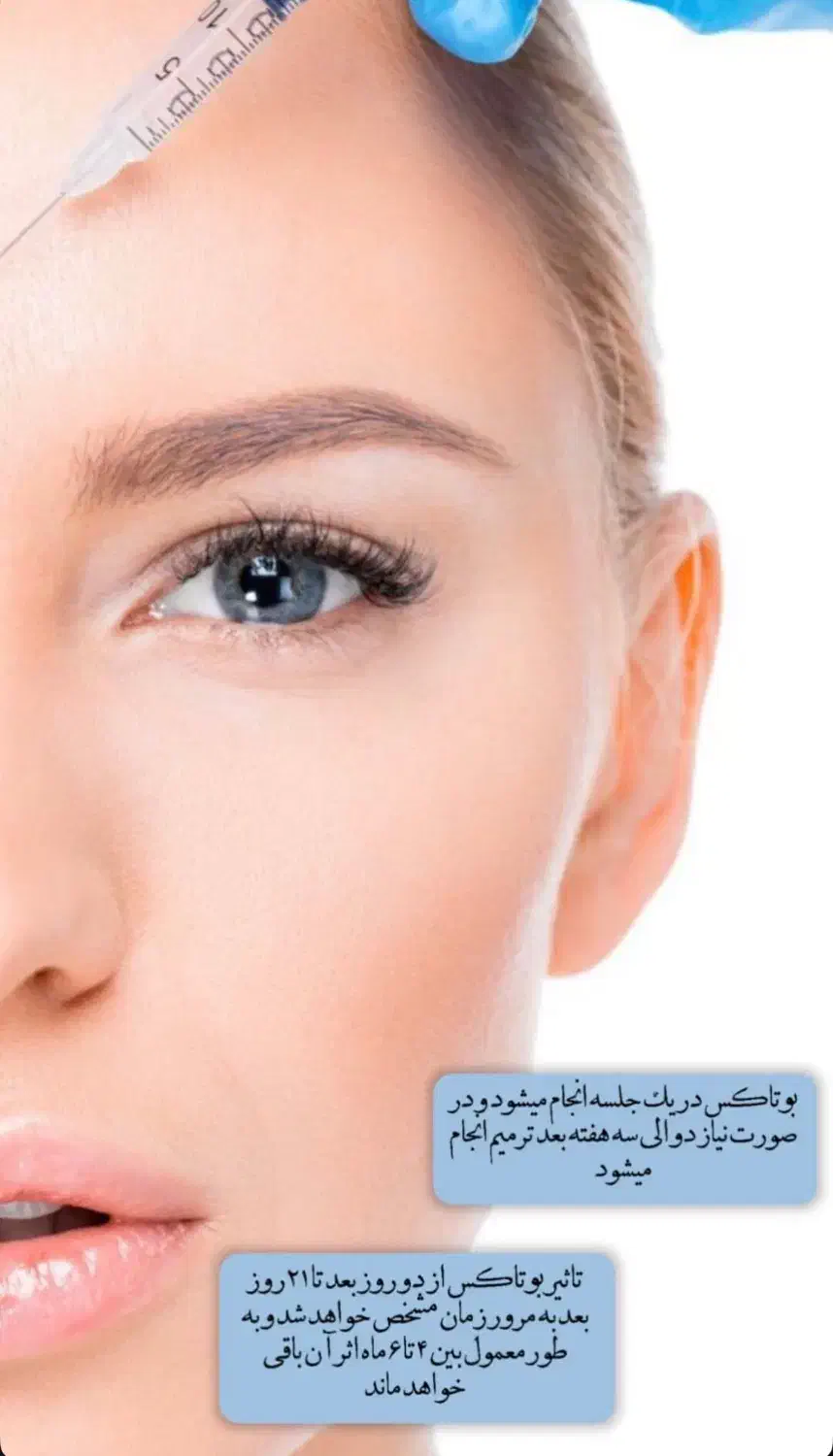 جشنواره تخفیفی بوتاکس در محیط لوکس|خدمات آرایشگری و زیبایی|آمل, |دیوار