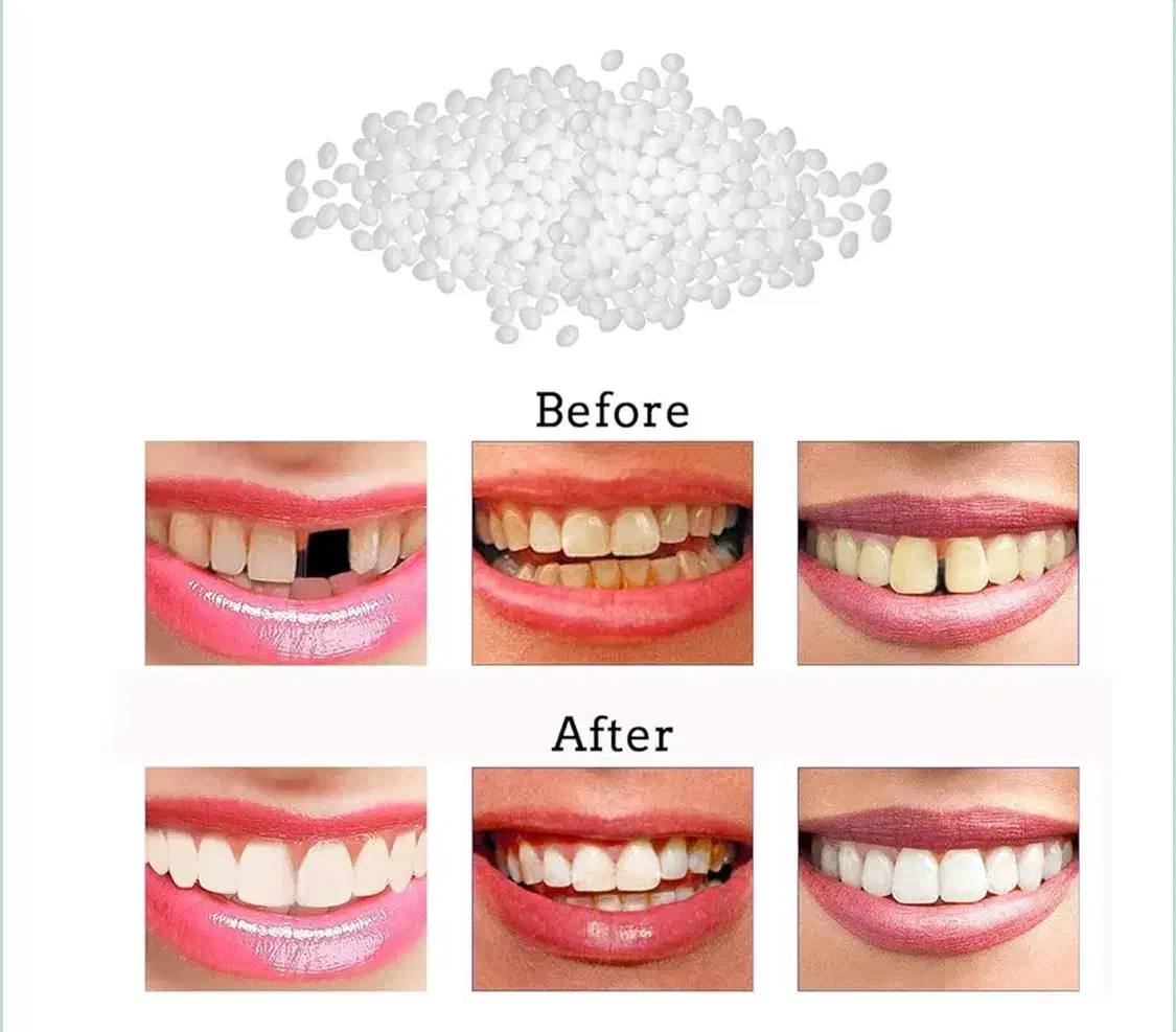 پروتز موقت دندان|آرایشی، بهداشتی، درمانی|اهواز, زردشت|دیوار