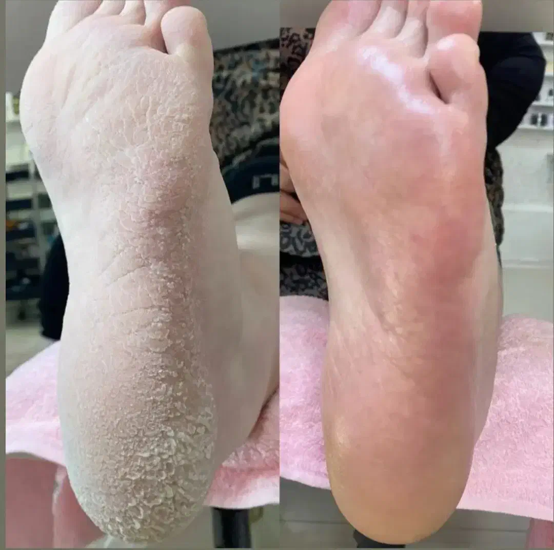 پدیکور و کف سابی کف پا|خدمات آرایشگری و زیبایی|آمل, |دیوار