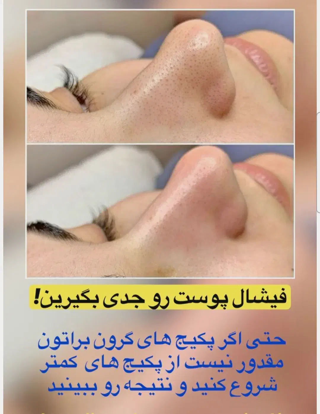 فیشیال و ماساژ درمانی و ریلکسی تخصصی با ۲۰ درصد آف|خدمات آرایشگری و زیبایی|شیراز, ابیوردی|دیوار