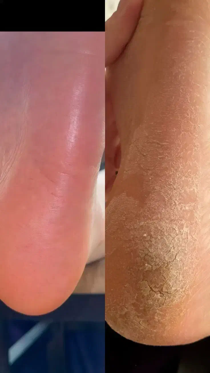 آف50درصدی آموزش و خدمات پدیکوردرمانی تا آخر ماه280|خدمات آرایشگری و زیبایی|آبادان, |دیوار