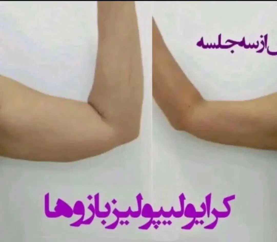 آب درمانی لاغری نمک درمانی درد مفاصل|خدمات آرایشگری و زیبایی|قم, قلعه یزدیها|دیوار