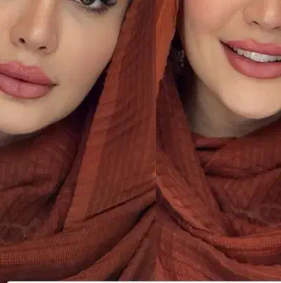 کش لیفت غبغب|پزشکی|میانه, |دیوار