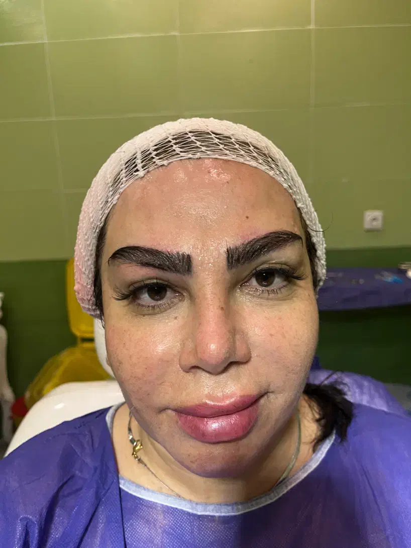 مدل کاشت ابرو|خدمات آرایشگری و زیبایی|گرگان, |دیوار