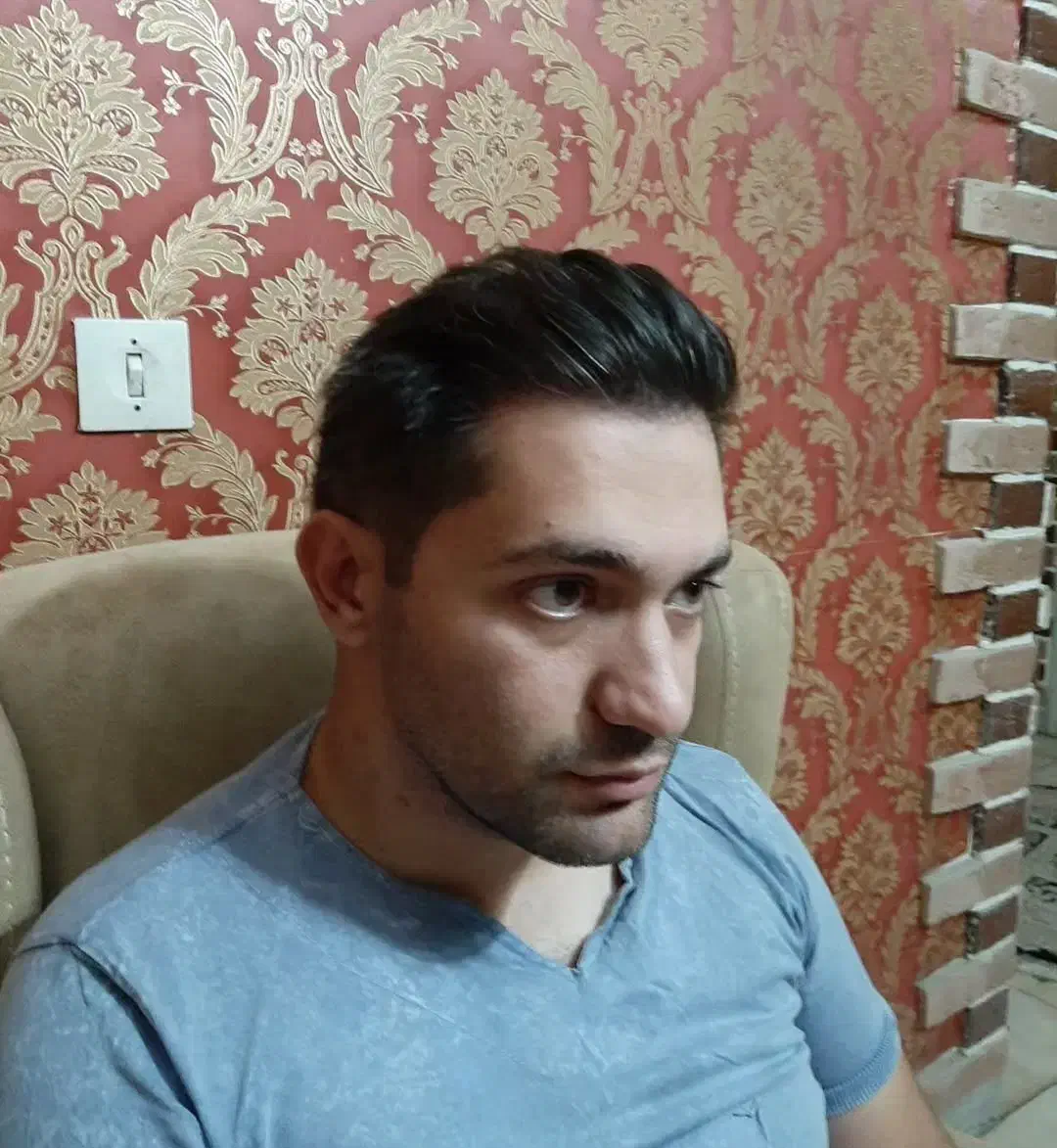 بلفاروپلاستی ،سانترال،دایرکت ابرو،کاشت vipجشنواره|خدمات آرایشگری و زیبایی|تهران, تجریش|دیوار