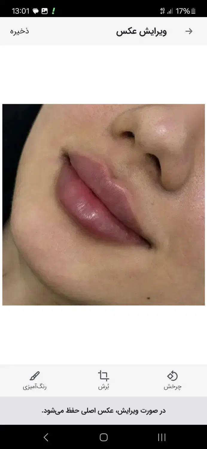 تزریق ژل بوتاکس|خدمات آرایشگری و زیبایی|شیراز, نصرآباد|دیوار