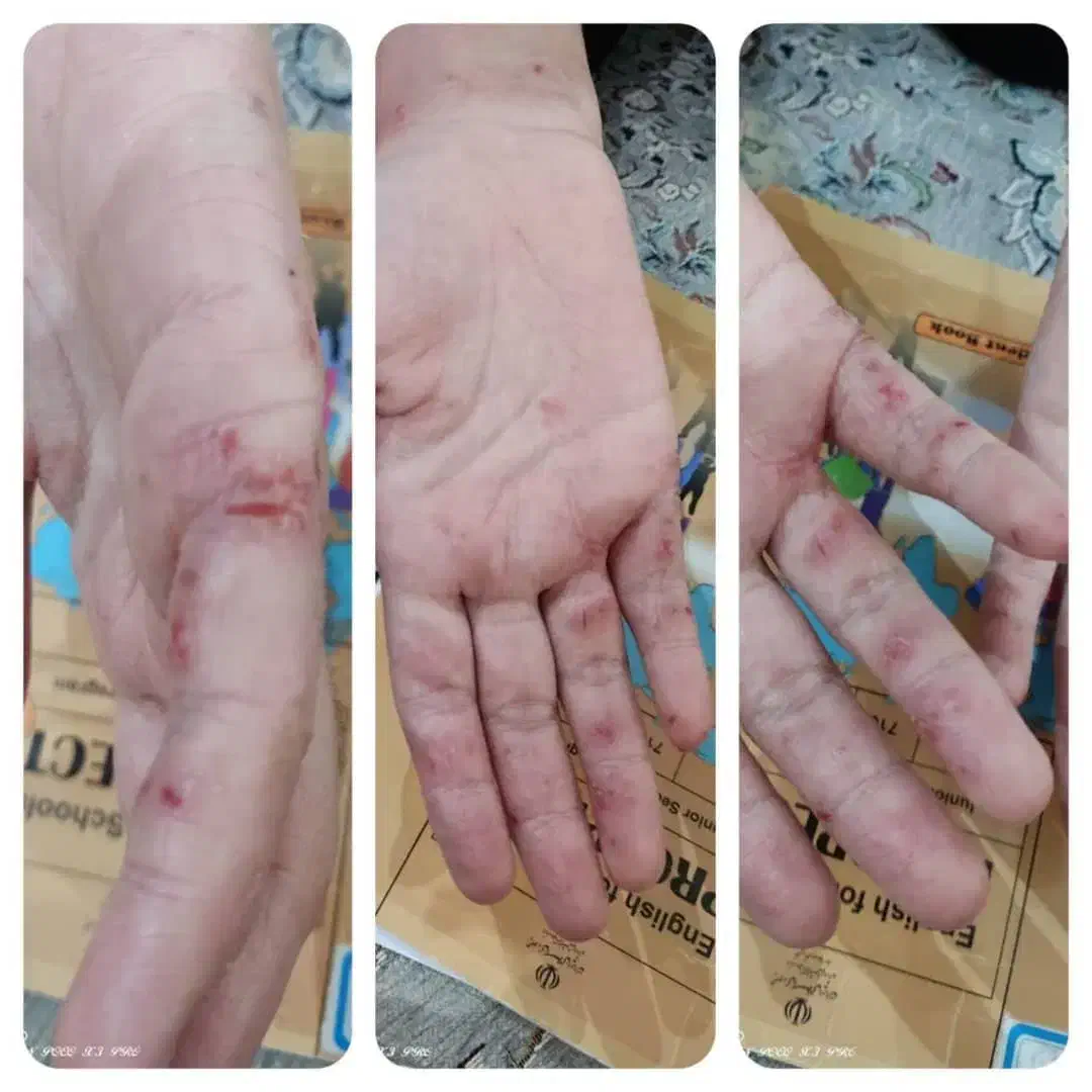 مشاوره طب سنتی رایگان|خدمات آرایشگری و زیبایی|ایرانشهر, |دیوار