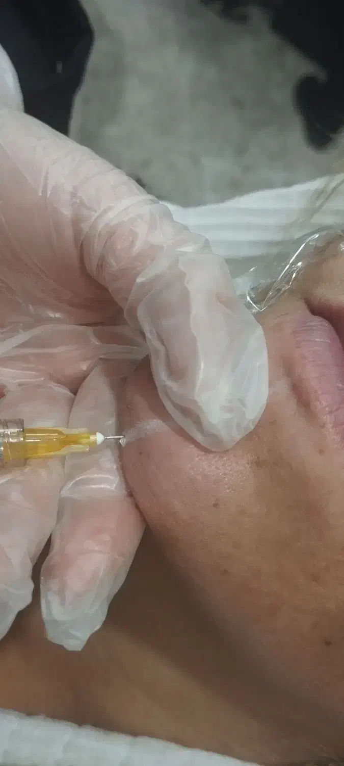 ژل سی سی 550  فیلر لب و گونه چانه و بوتاکس650|خدمات آرایشگری و زیبایی|قم, شهرک توانیر|دیوار