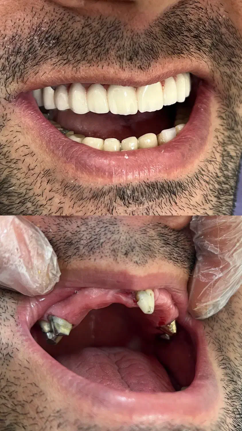 دندانپزشکی با پرداخت یک سوم هزینه|خدمات آرایشگری و زیبایی|سقز, |دیوار