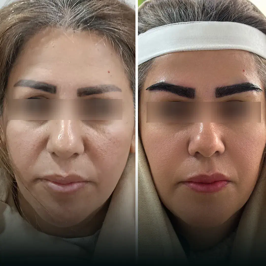 کلینیک VIP و تخصصی پوست، مو و زیبایی پارسامهر|خدمات آرایشگری و زیبایی|شیراز, عفیف‌آباد|دیوار