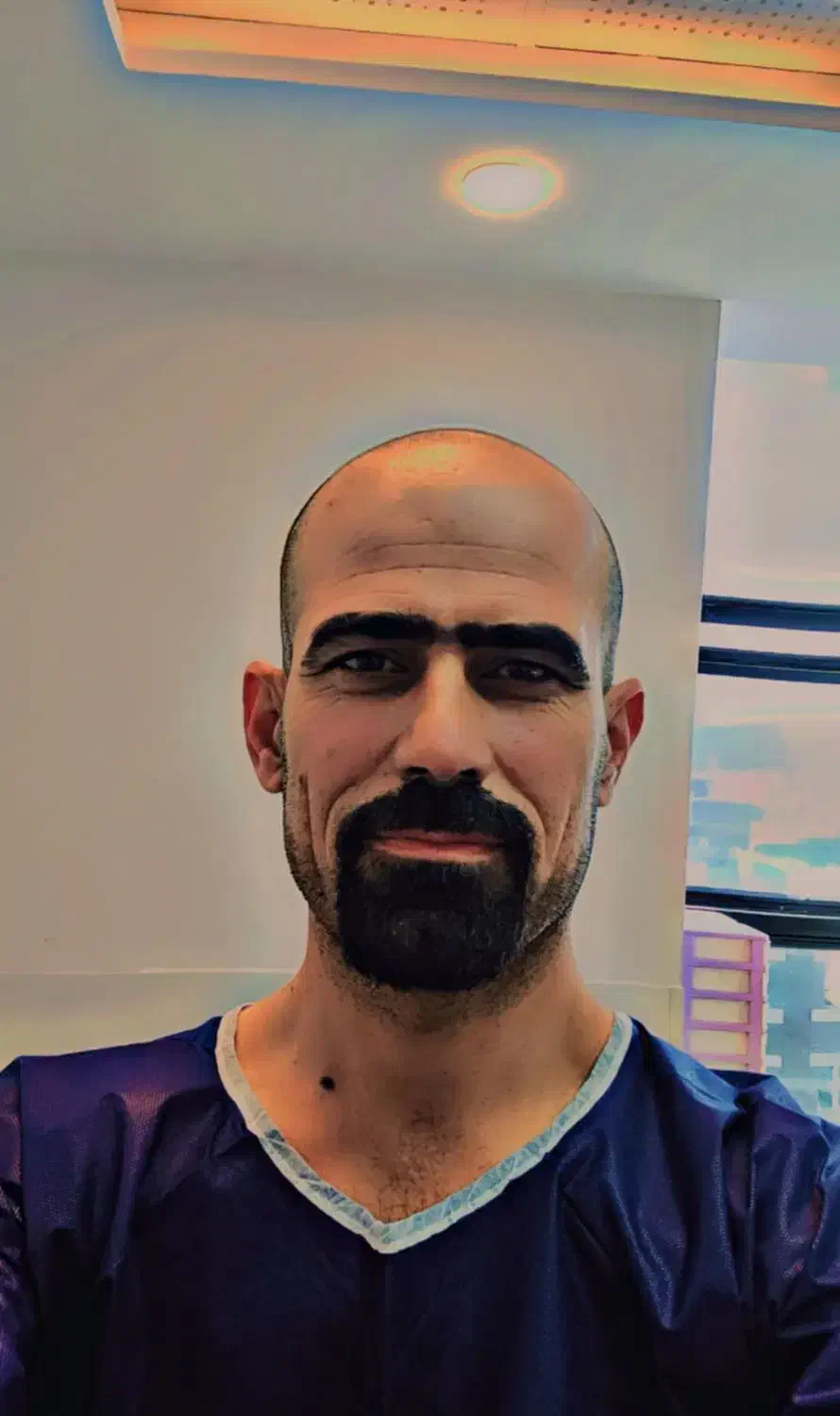 کلینیک کاشت مو|خدمات آرایشگری و زیبایی|مریوان, |دیوار