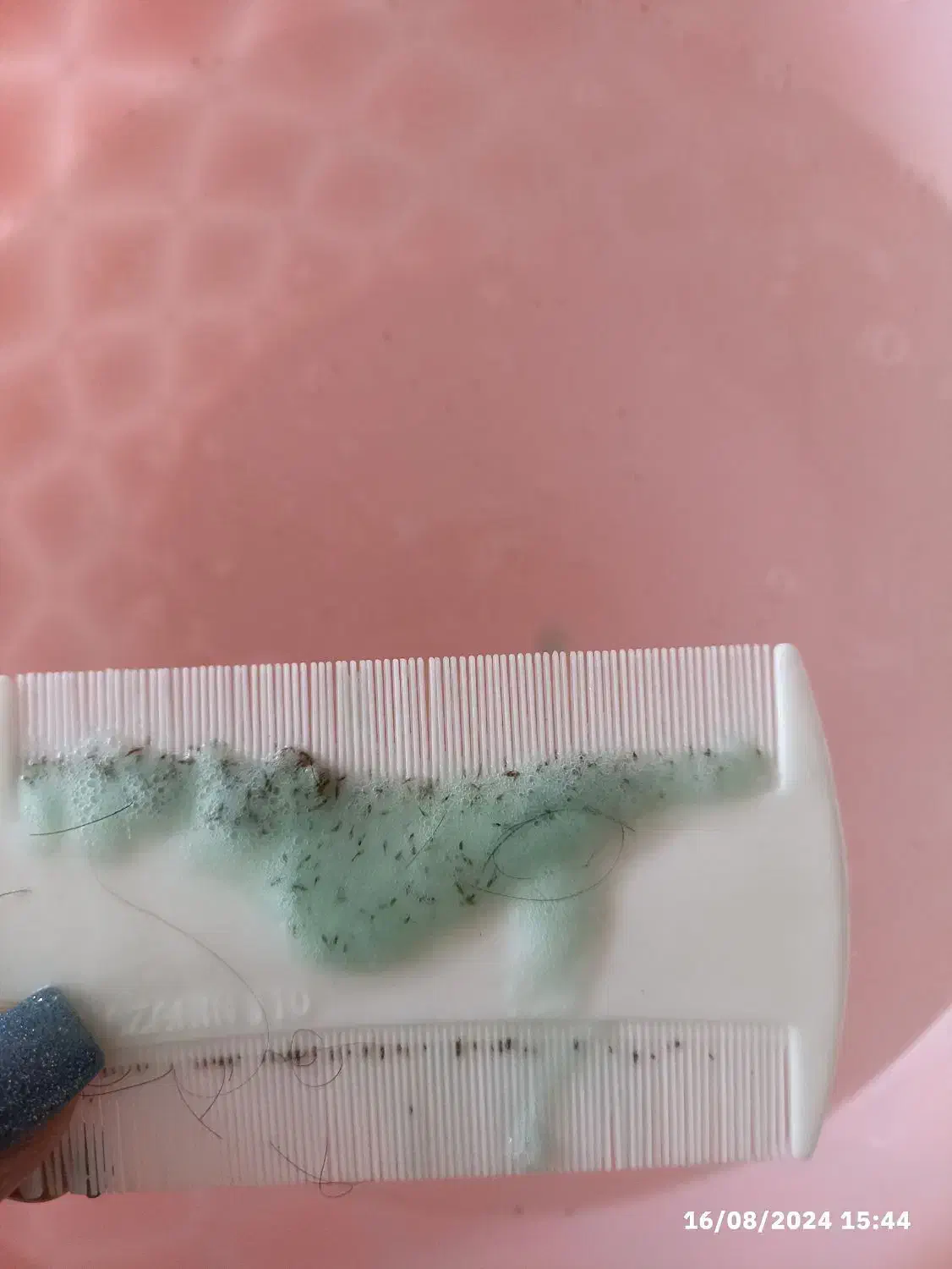 پاکسازی شپش و رشک|آرایشی، بهداشتی، درمانی|زرگرشهر, |دیوار