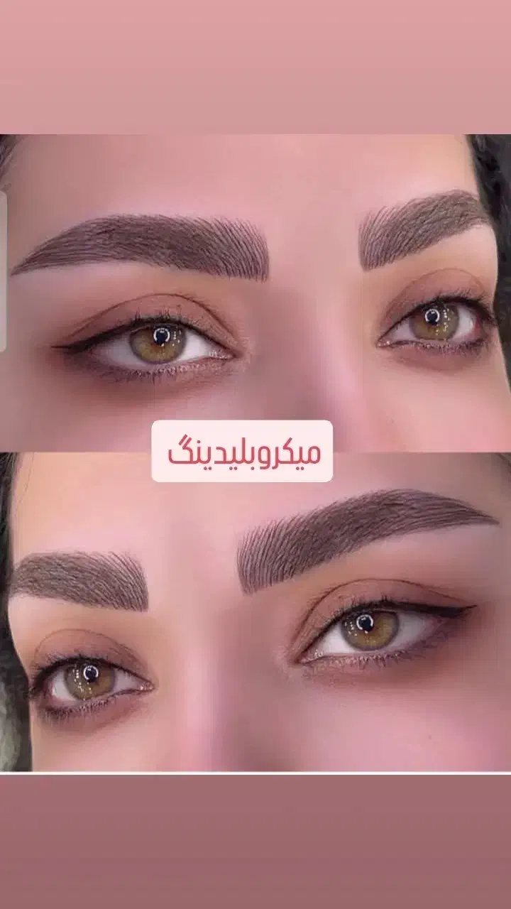 ابرو/لیزر پوست /شیدینگ/لیزر مو سفید/درمان کبد چرب|خدمات آرایشگری و زیبایی|خرم‌آباد, |دیوار