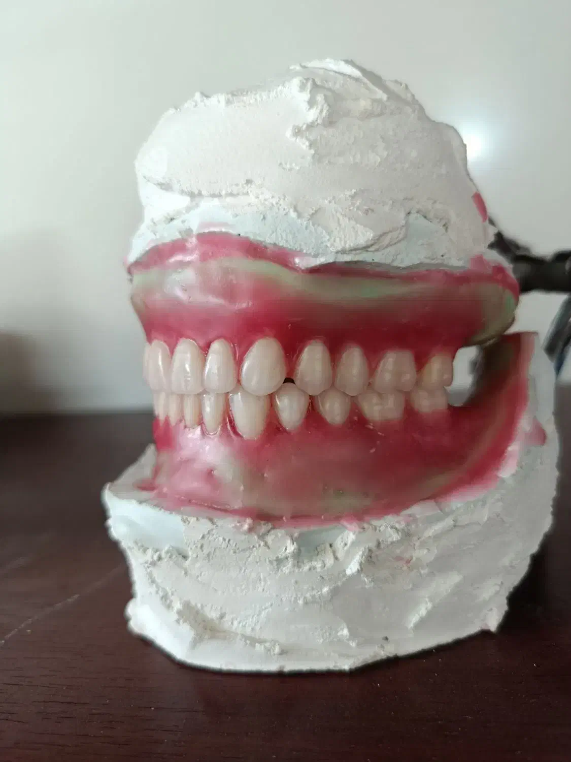 پروتز متحرک دندان|آرایشی، بهداشتی، درمانی|گنبد کاووس, |دیوار