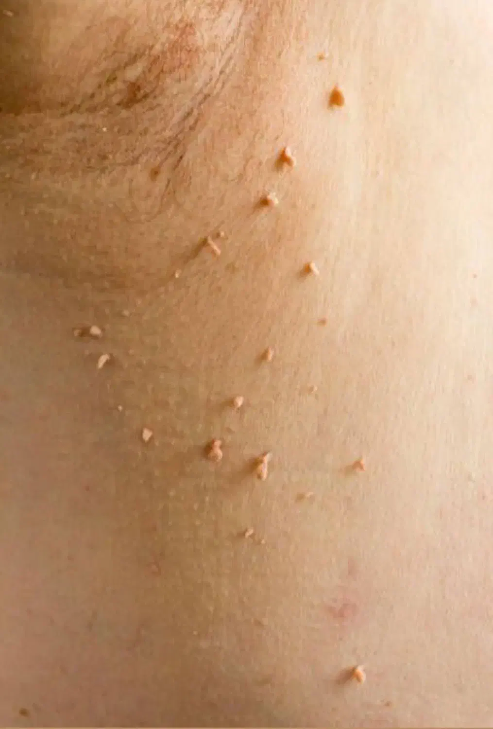 مشاوره تخصصی ویروسهای خاص بدن (مشاوره محرمانه)|آرایشی، بهداشتی، درمانی|گنبد کاووس, |دیوار