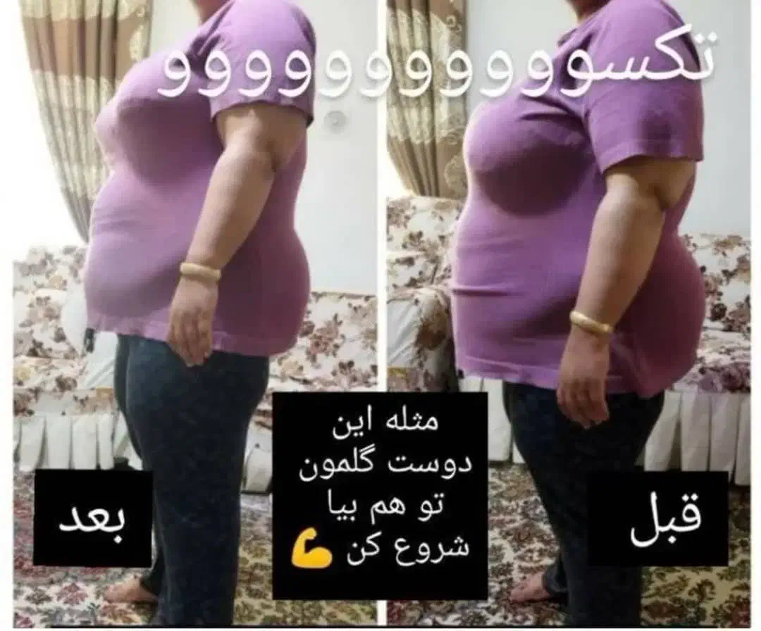 درمان مشکلات بدنی|آرایشی، بهداشتی، درمانی|سیرجان, |دیوار