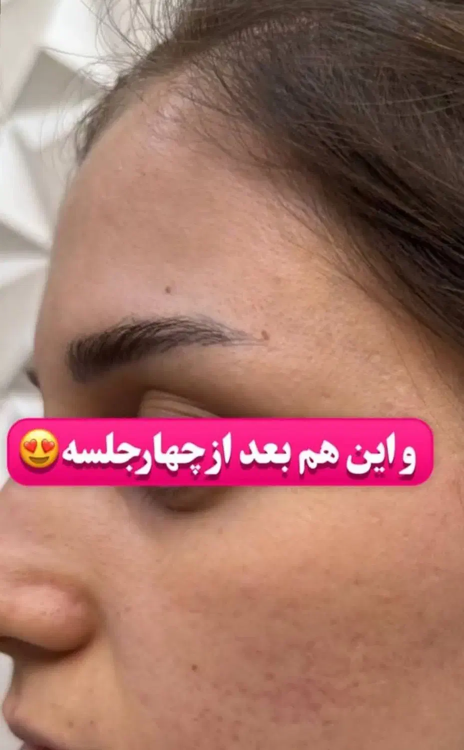 فیشیال وپاکسازی پوست ویژه بانوان|خدمات آرایشگری و زیبایی|سقز, |دیوار