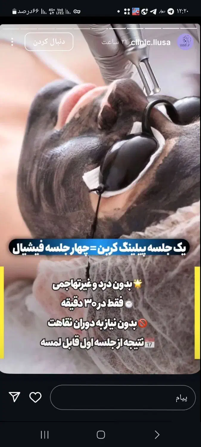 پاک کردن تتو با کیوسوییچ|خدمات آرایشگری و زیبایی|ارومیه, |دیوار