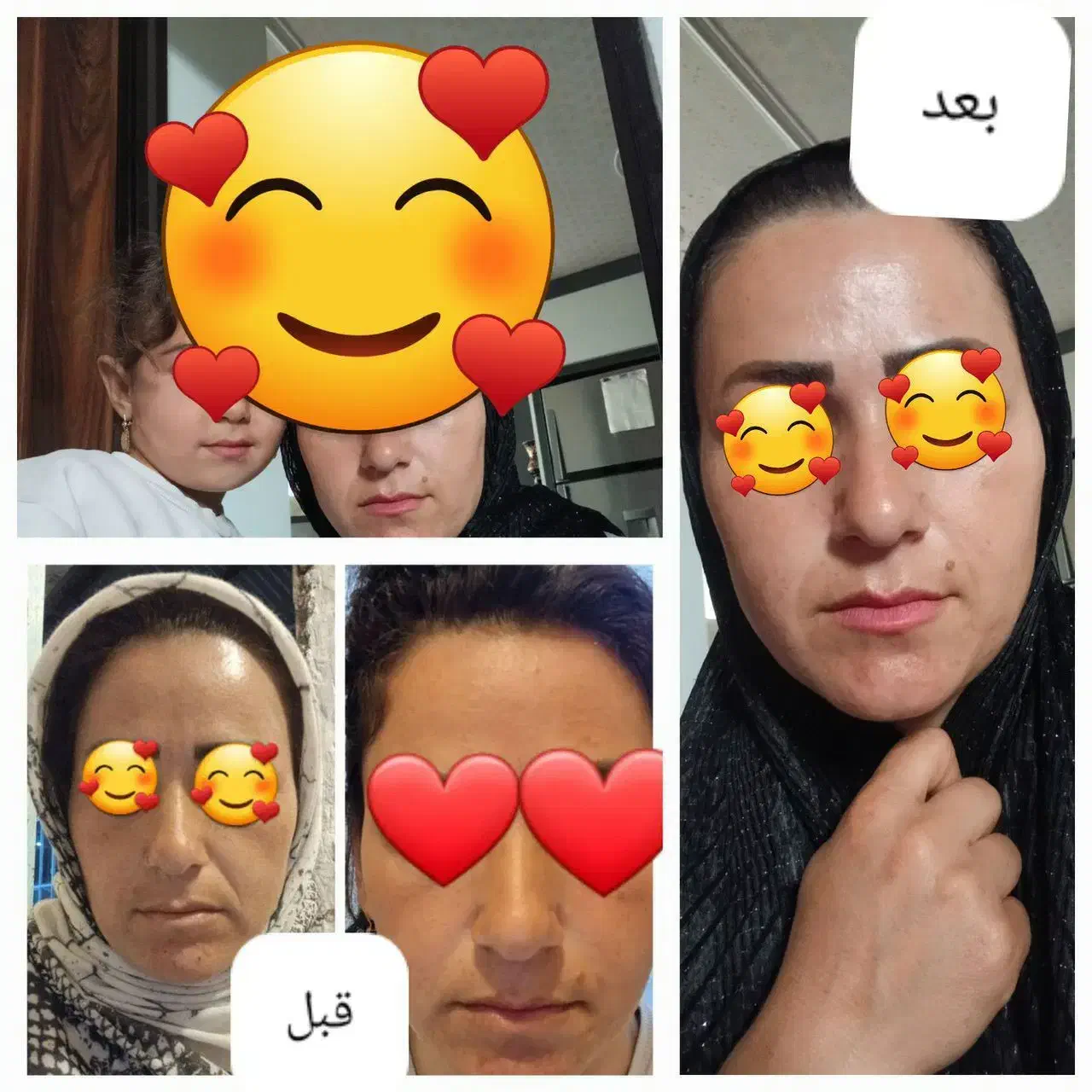 پوست و مو|آرایشی، بهداشتی، درمانی|زبرخان, |دیوار