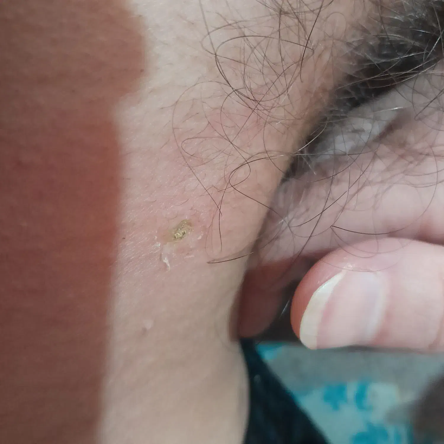 خدمات زیبایی پوست و خال برداری خانم واقا|خدمات آرایشگری و زیبایی|ساوه, |دیوار