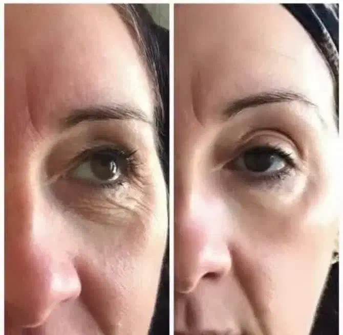 محصولات مراقبت پوستی|آرایشی، بهداشتی، درمانی|کامفیروز, |دیوار