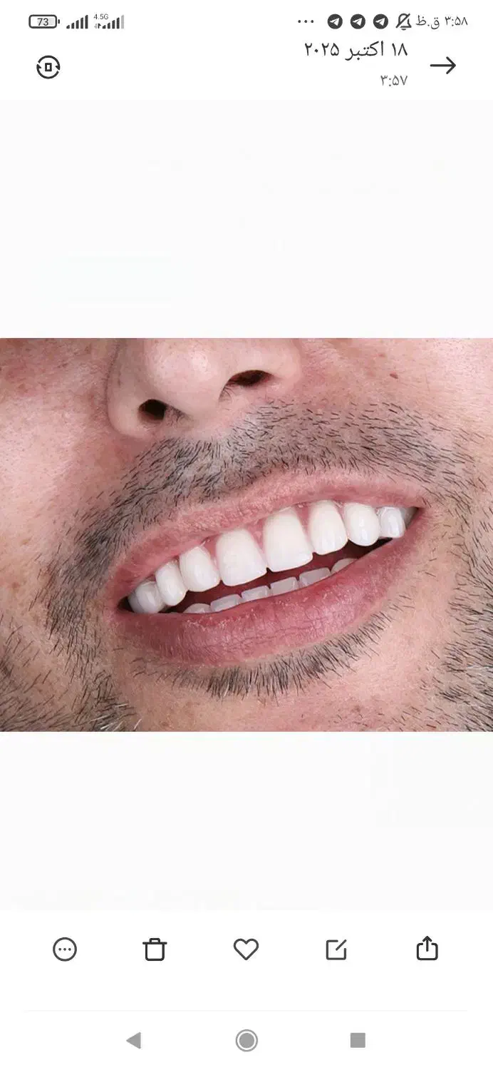 زیبایی|خدمات آرایشگری و زیبایی|محلات, |دیوار