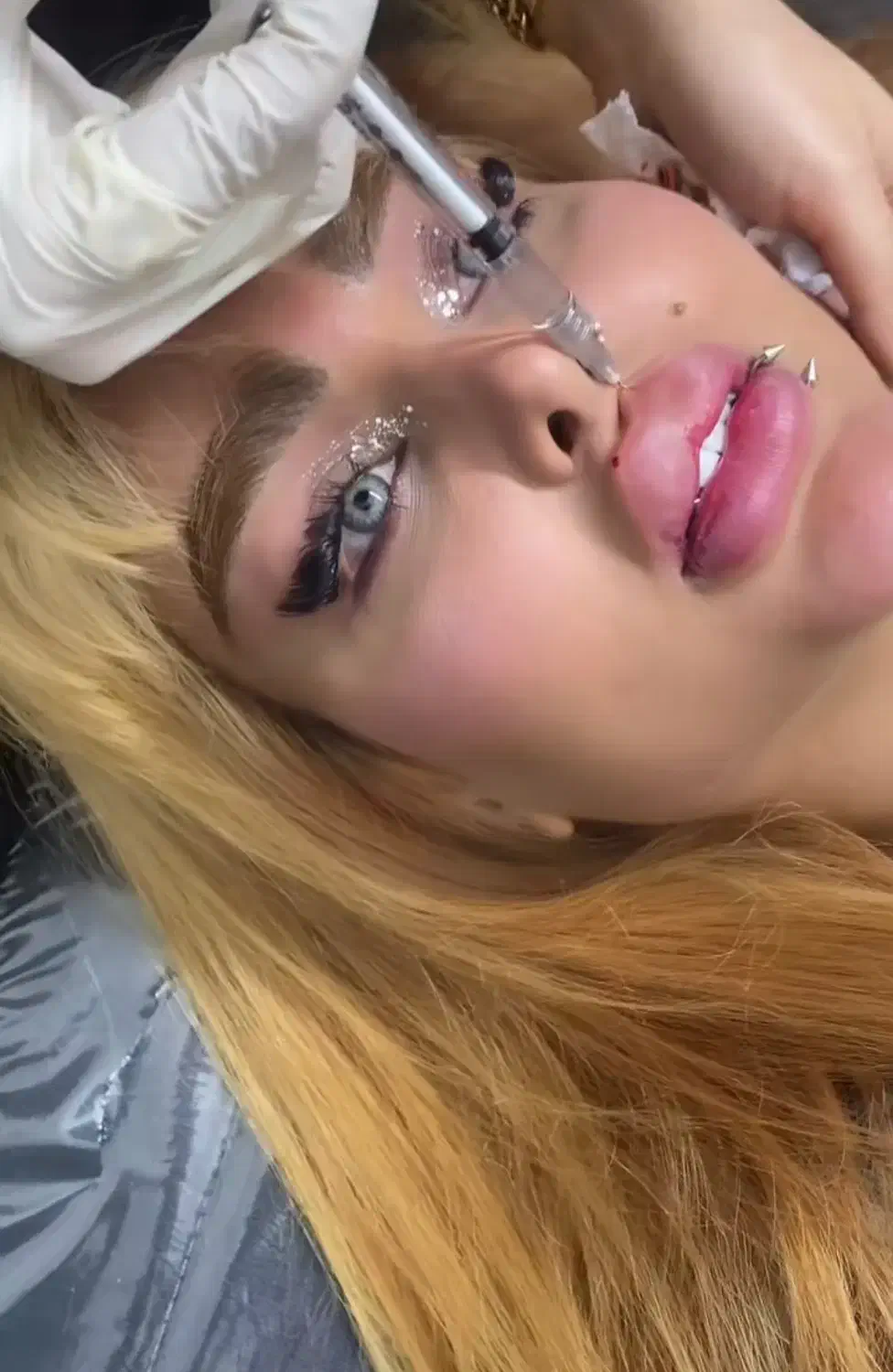 تزریقات ژل و بوتاکس|خدمات آرایشگری و زیبایی|گرگان, |دیوار