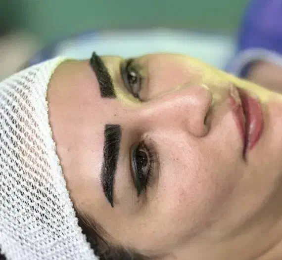 کاشت مو و ابرو به روش سوپر fue پلاس(fue-sfue)|خدمات آرایشگری و زیبایی|شیراز, قدوسی غربی|دیوار