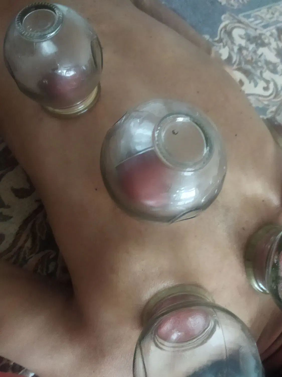 حجامت و بادکشی در منزل|خدمات آرایشگری و زیبایی|بیرجند, |دیوار