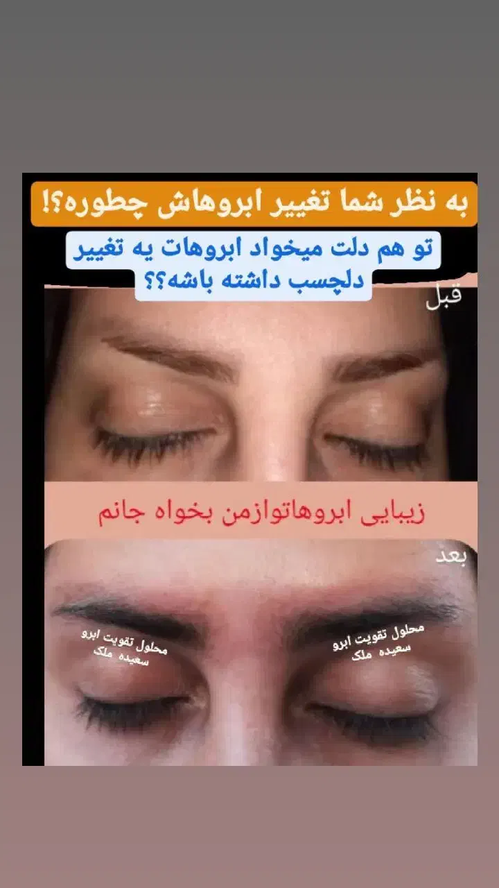 محلول رویش و رشد مجدد ابرو و مژه ملک|آرایشی، بهداشتی، درمانی|شاهرود, |دیوار