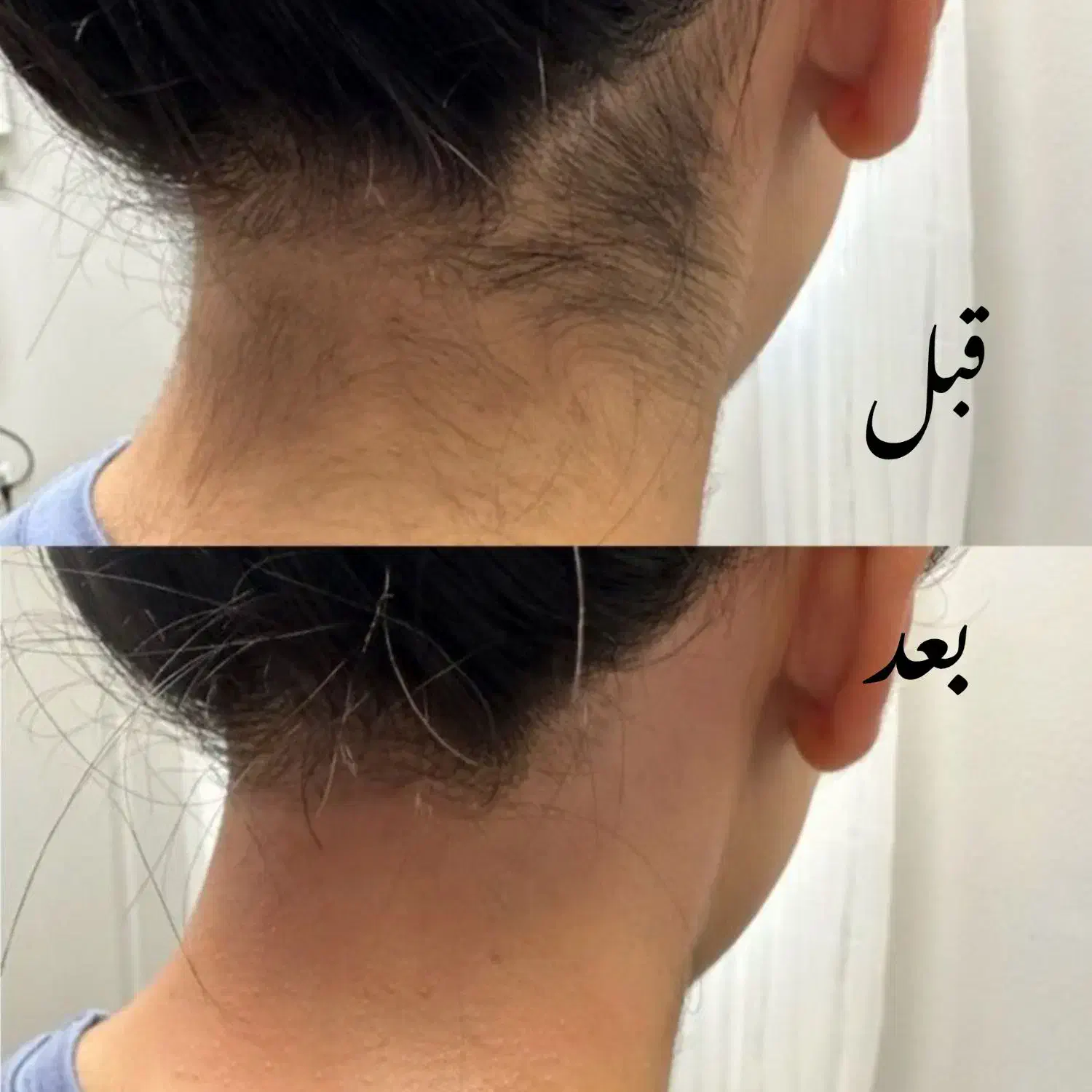 اپیلاسیون و اموزش با مدرک فنی حرفه ای|خدمات آرایشگری و زیبایی|مشهد, گلشور|دیوار