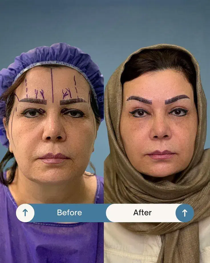 جراحی صورت ۵۰درصد تخفیف|خدمات آرایشگری و زیبایی|تهران, دروس|دیوار