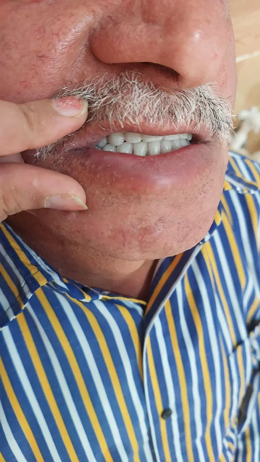 ساخت دندان مصنوعی|پزشکی|سنندج, |دیوار