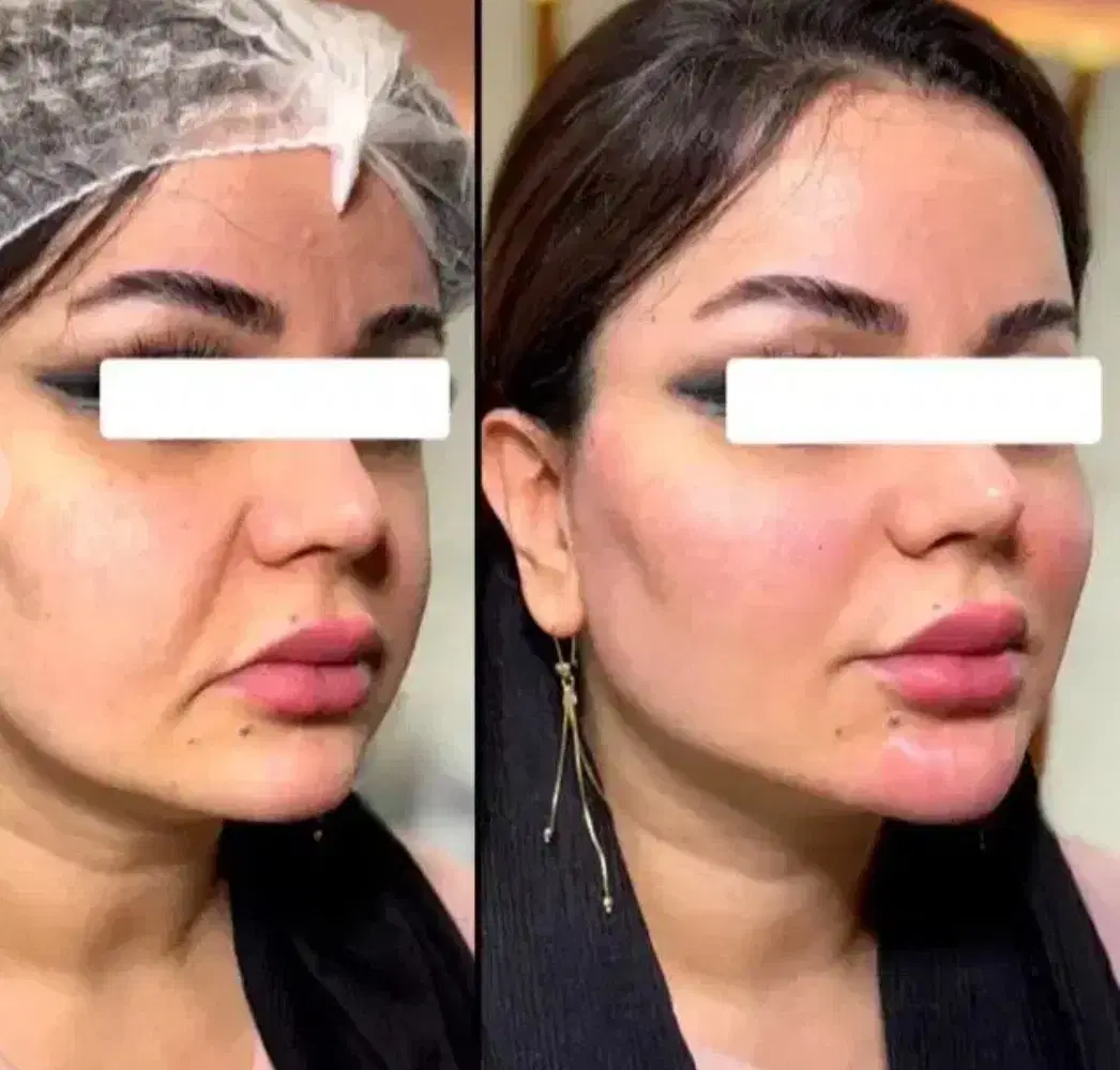 پکیجهای باور نکردنی با کمترین قیمت ژل و انزیم۳۰۰|خدمات زیبایی و سلامت|اهواز, کیانپارس |دیوار