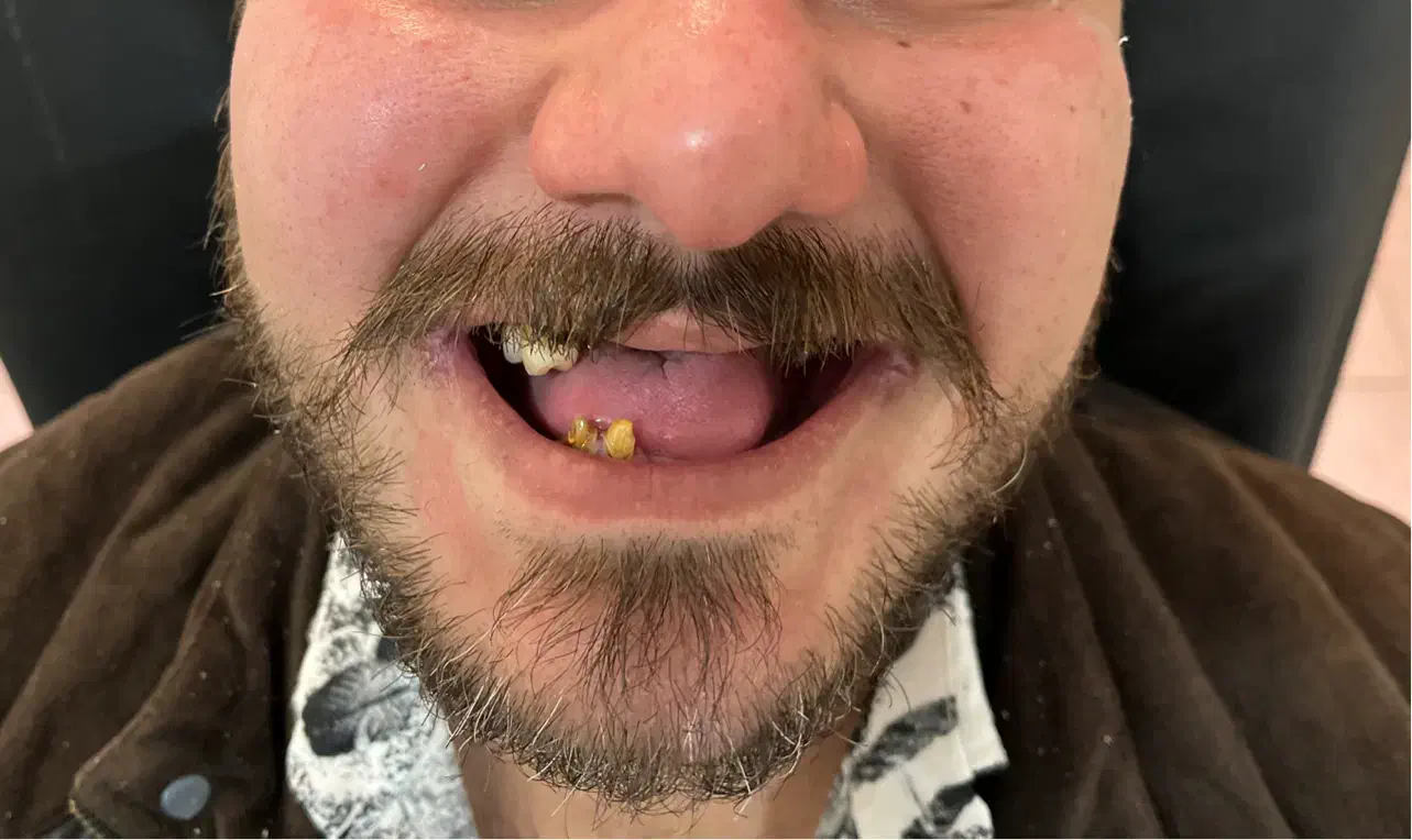 دندان مصنوعی + دندانسازی|خدمات آرایشگری و زیبایی|تهران, شمشیری|دیوار