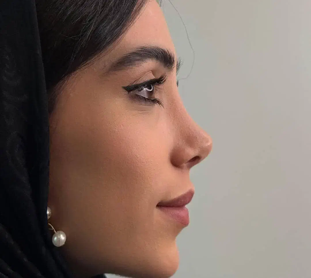 جراحی.بینی|خدمات آرایشگری و زیبایی|اراک, |دیوار