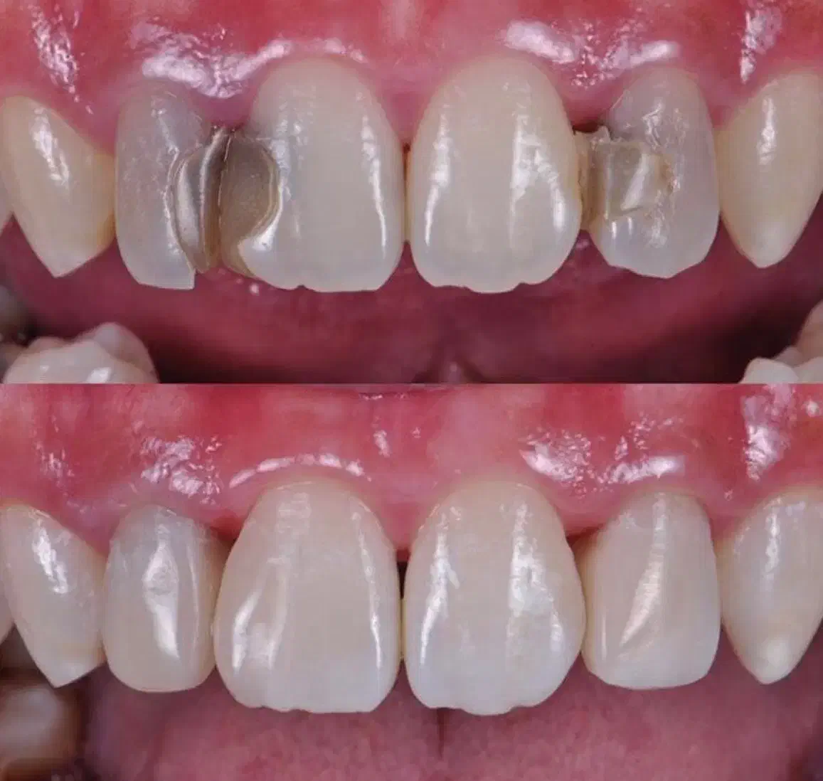 جشنواره یلدایی خدمات دندانپزشکی|خدمات آرایشگری و زیبایی|اردبیل, |دیوار