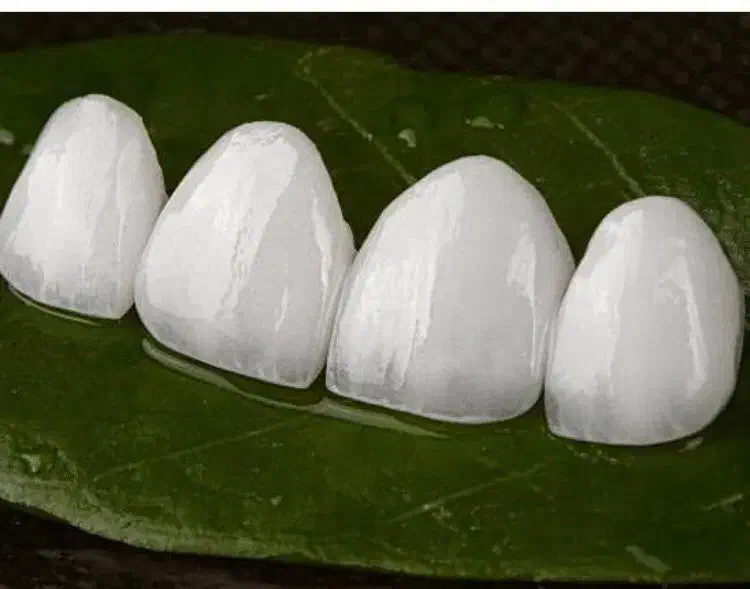 دستیار دندانپزشک مشیریه|استخدام درمانی، زیبایی، بهداشتی|تهران, مشیریه|دیوار