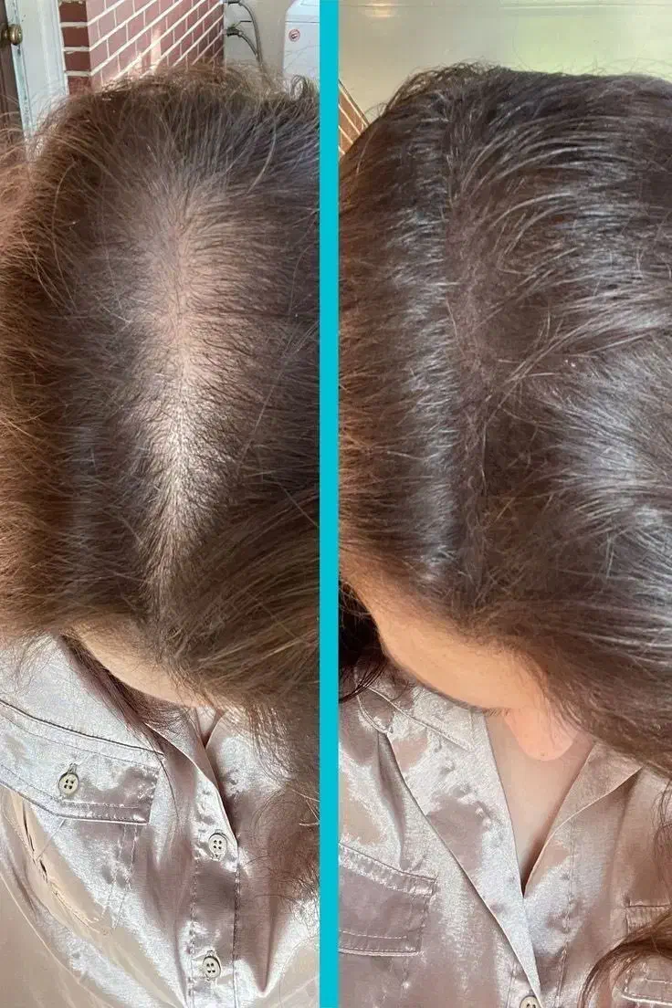برای اولین بار در شمال کشور لاغری تضمینی|خدمات آرایشگری و زیبایی|چالوس, |دیوار