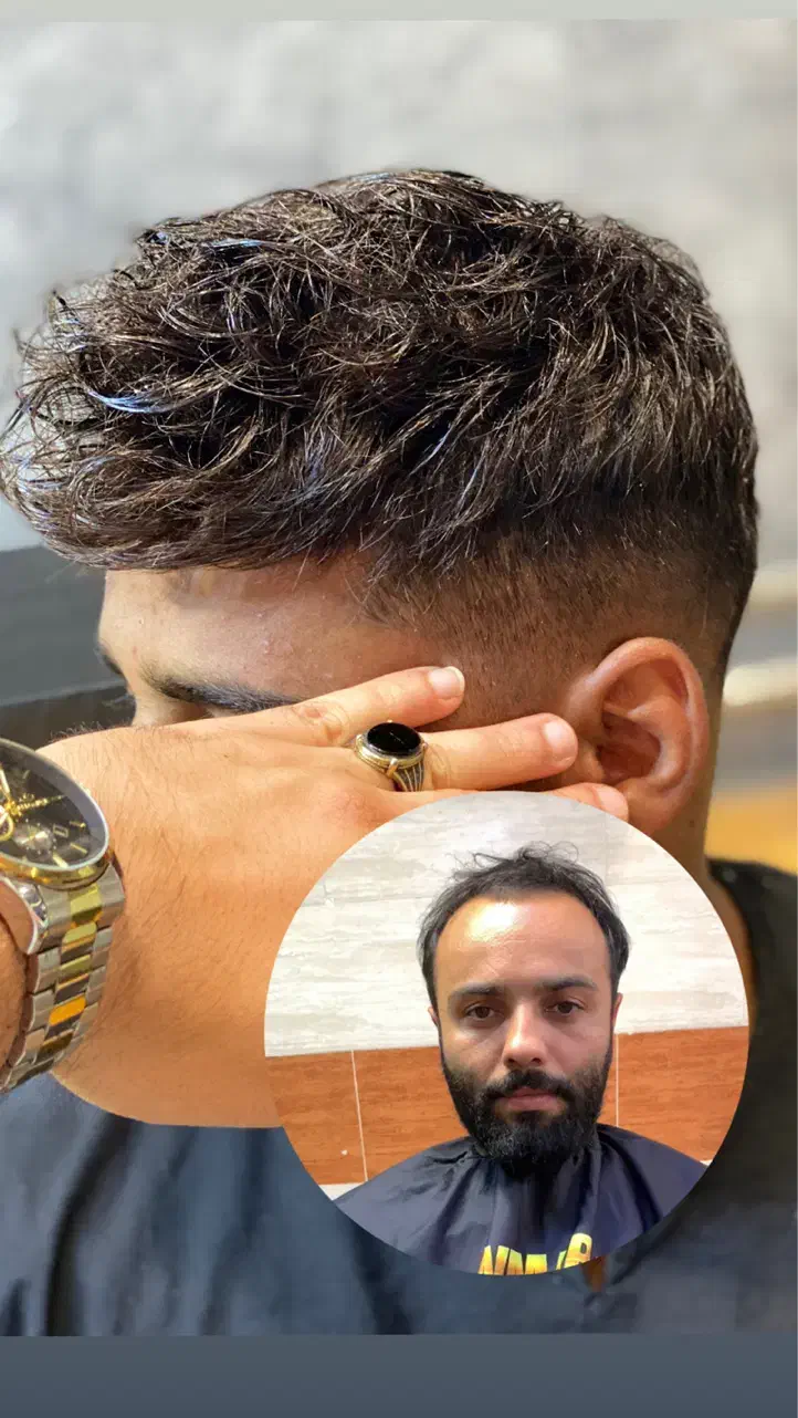 ترمیم و پروتز|خدمات آرایشگری و زیبایی|تبریز, |دیوار