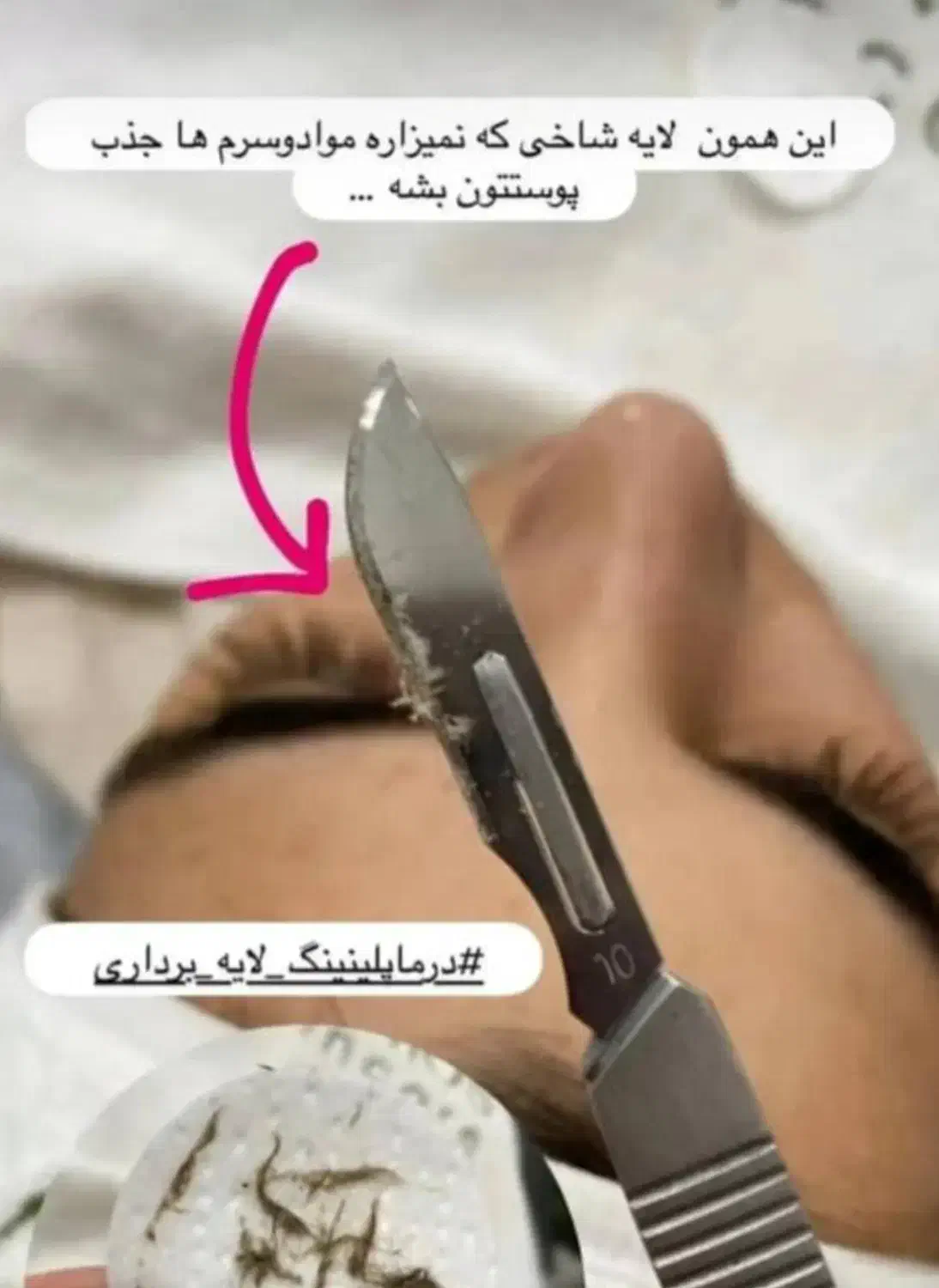 فیشال و جوانسازی پوست|خدمات آرایشگری و زیبایی|شیراز, تحویلی|دیوار