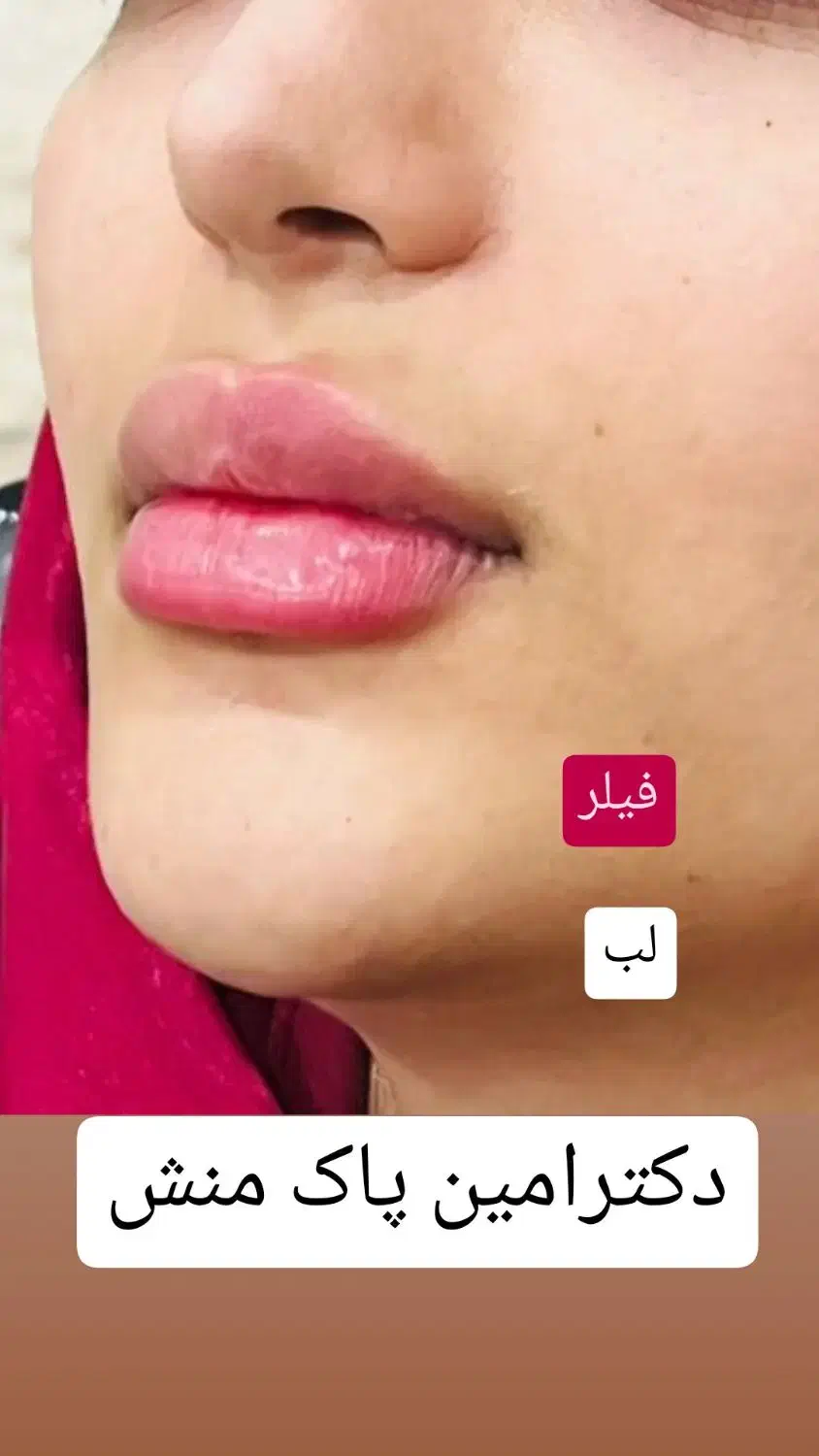 مطب دکتر پاک منش|خدمات آرایشگری و زیبایی|بهبهان, |دیوار